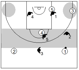 Gráfico de baloncesto que recoge una variante en medio campo de la zona 1-3-1 press